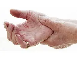 اعراض الروماتويد المبكرة