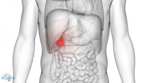 اعراض المرارة