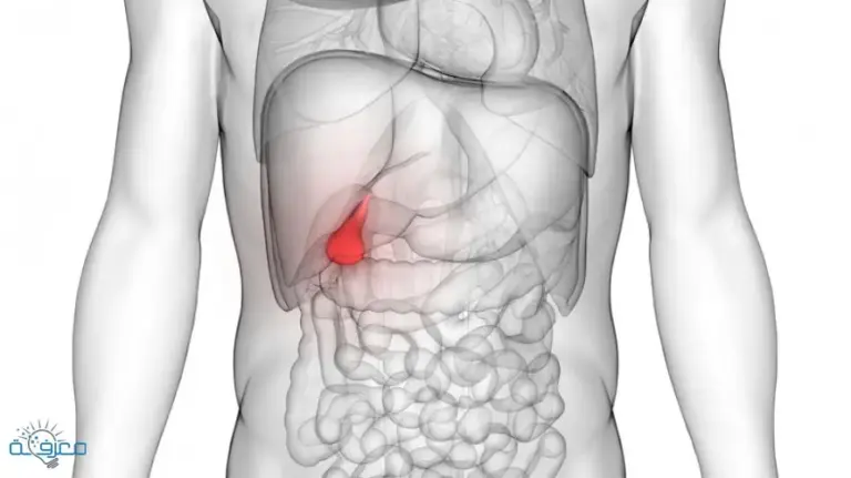 اعراض المرارة